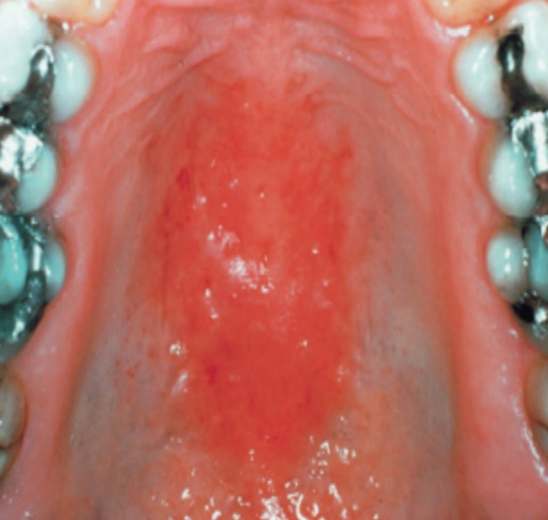 <p>• Name of lesion:</p><p>• Causative organism:</p><p>• Describe the lesion:</p>