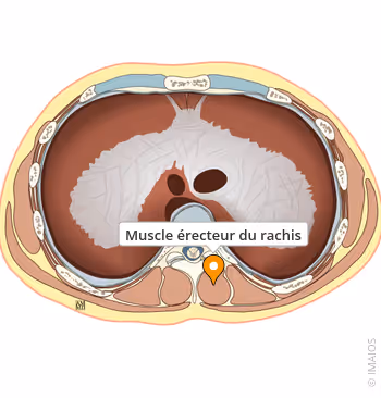 <p>Érecteur du rachis </p>