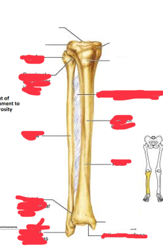 <p>Where is the medial condyle of the tibia </p>
