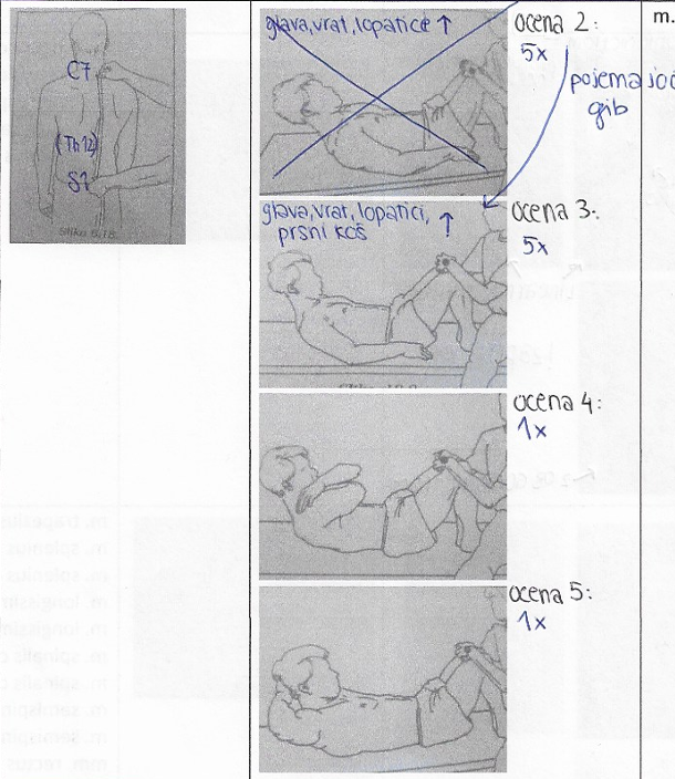<p>fleksija trupa</p>