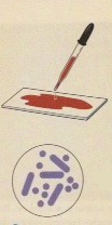 <p>Gram's Iodine, helps to trap the crystal violet in the peptidoglycan layer of Gram positive cells, which resist loss of the primary due during decolorization with alcohol; gram negative give up color.</p>