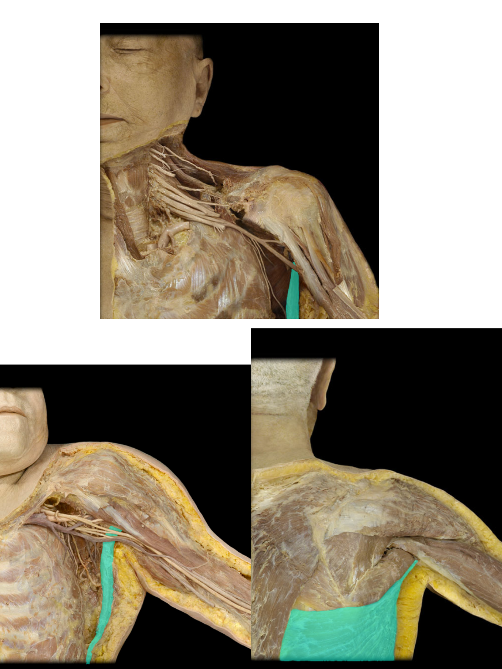 <p>Latissimus dorsi m.</p>