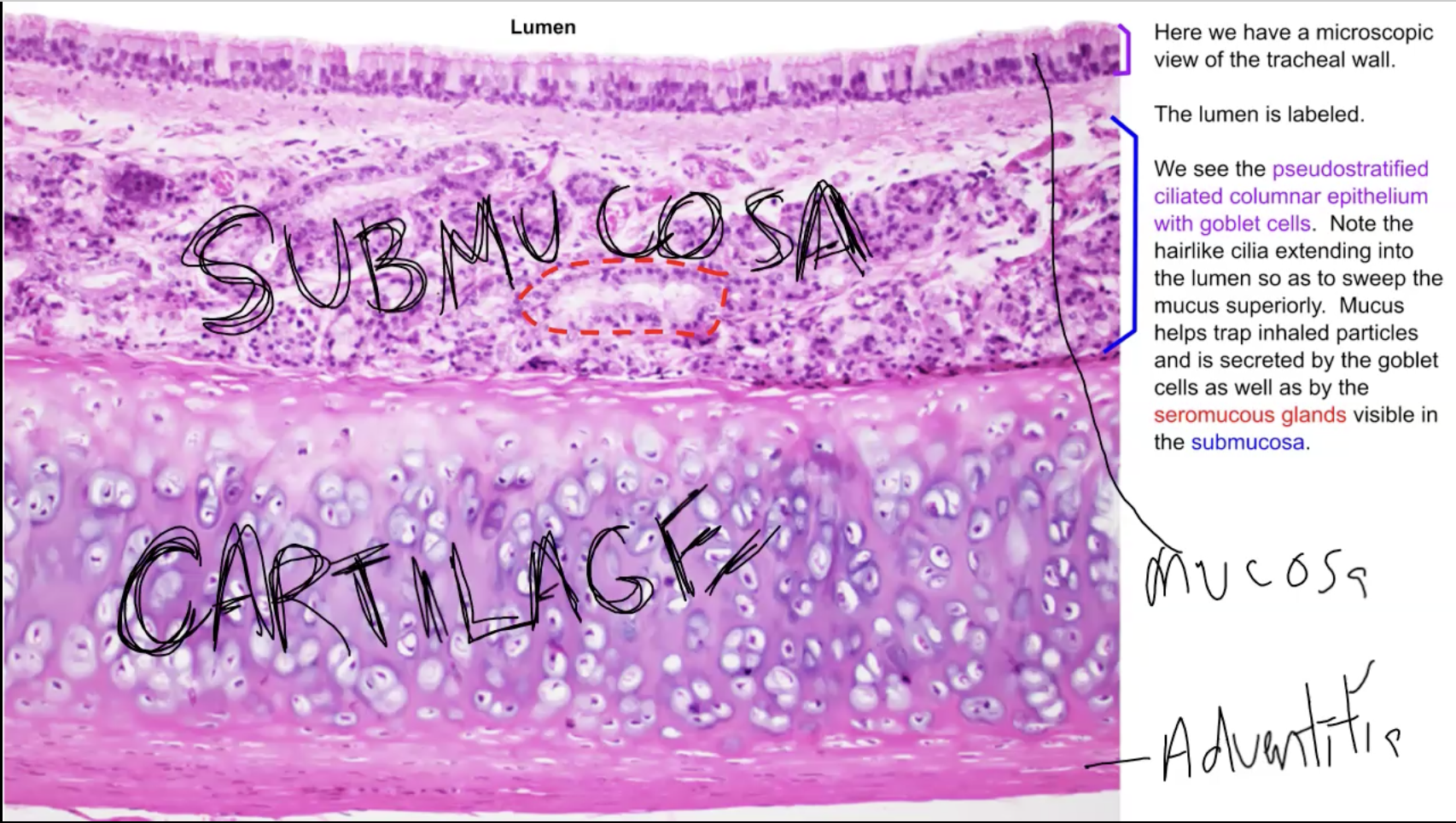 <p>What is the</p><p>Red: Seromucous glands</p><p>Purple: Mucosa (made of Pseudostratified ciliated columnar epithelium with goblet cells)</p><p>Blue: Submucosa (contains various things like nerves, arteries, veins, glands, etc)</p><p>Green: Cartilage - strengthens the trachea and keeps it open.</p><p>Yellow: Adventitia. The adventitia is sticky which keeps the trachea in place and allows it to stick to neighboring structures.</p><p></p>