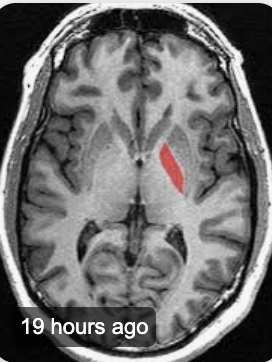 <p>Name this area of the brain</p>