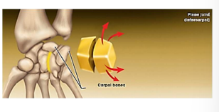 <p>Planar joint</p>