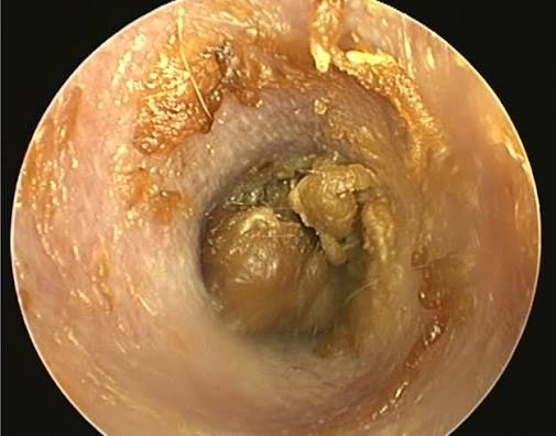 <p>Otoscopy (Ear Mites)</p>