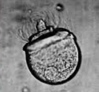 <p>The picture shows a Ginkgo biloba sperm cell. Describe one feature and explain why this feature is required for fertilization.</p>