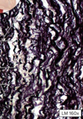 <p>-Elastic fibers</p><p>-Found in arteries</p>