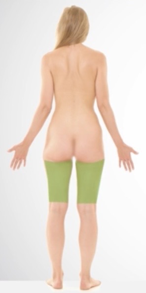 <p>Femur</p>