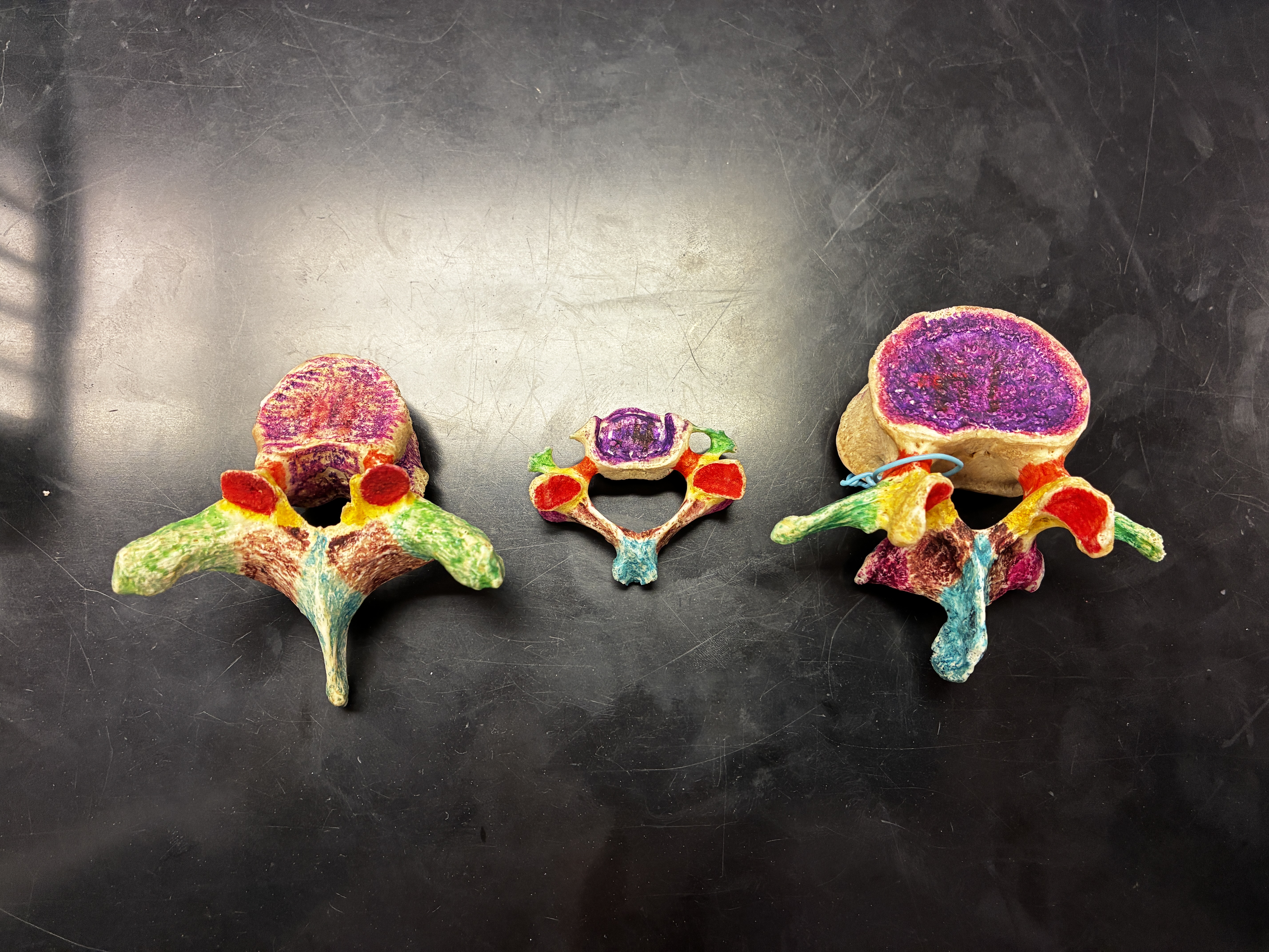 <p>What’s the name of the Purple part on the 3 models?</p>