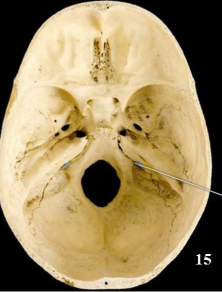 <p>Name this Foramen</p>