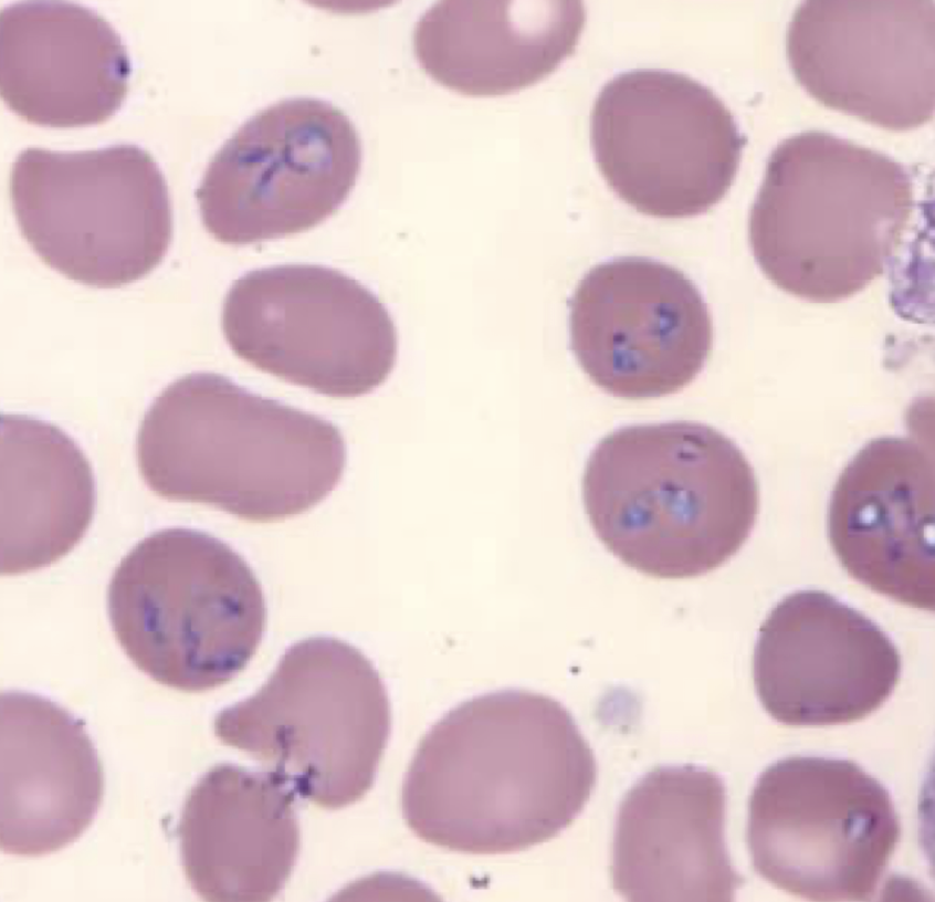 <p>What parasite is this?</p>