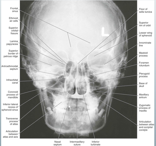 <p>-”PA ceph”</p><p>-ortho uses to evaluate facial asymmetry</p>