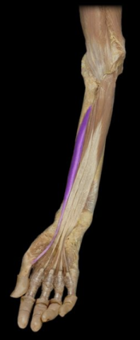 <p>What the highlighted structure is acting on the <strong><mark data-color="#ffdb9c" style="background-color: rgb(255, 219, 156); color: inherit;">Wrist and Hands</mark>.</strong> What muscle is this called?</p>