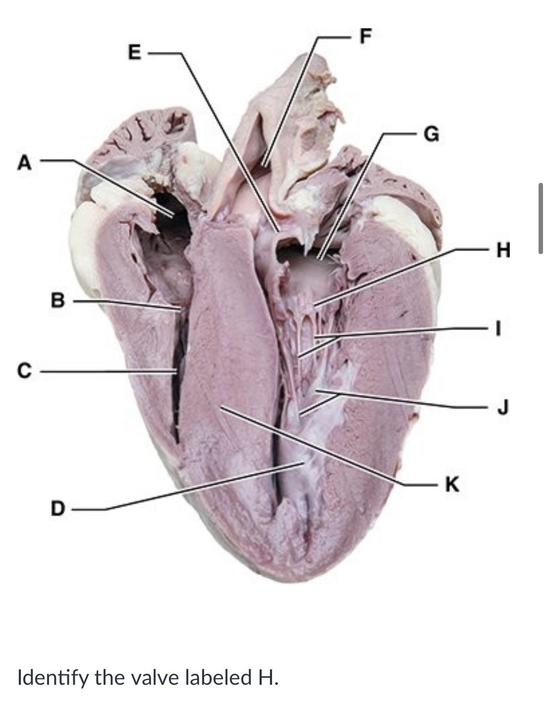 <p><span>Pulmonary semilunar (SL) valve</span></p><p><span>Bicuspid (mitral) valve</span></p><p><span>Tricuspid valve</span></p><p><span>Aortic semilunar (SL) valve</span></p>