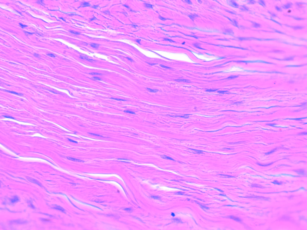 <p><span>Fibers line up in a parallel pattern. This gives strong resistance to pulling forces in one main direction. Found in tendons and ligaments</span></p>