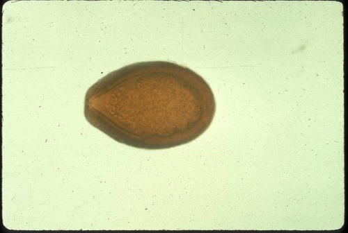 <p>Eimeria leuckarti</p>