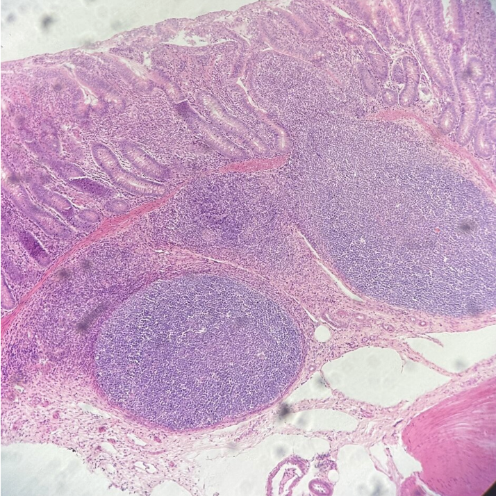 <p>Which segment of the digestive tract is this?</p>