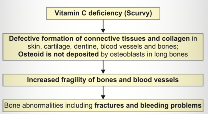 <p><span><strong>Cause of scurvy?</strong> → Vitamin C deficiency.</span></p><p></p><p><span><strong>At-risk children?</strong> → Heat-treated cow milk-fed infants.</span></p><p></p><p><span><strong>Basic defect?</strong> → Defective connective tissue and collagen formation.</span></p><p></p><p><span><strong>Clinical features?</strong> → Pallor, irritability, infections.</span></p><p></p><p><span><strong>Painful limb manifestation?</strong> → Subperiosteal hemorrhage causing pseudoparalysis.</span></p><p></p><p><span><strong>Chest finding?</strong> → Scorbutic rosary.</span></p><p></p><p><span><strong>Radiological findings -</strong></span></p><p>• Ground-glass appearance of long bones - due to trabecular atrophy with pencil thin cortex</p><p>• White line of Frãnkel: Seen at metaphysis, represents well-calcified cartilage</p><p>• Wimberger sign: Sclerotic ring around epiphyseal centers of ossification</p><p>• Trumerfeld zone: A zone of rarefaction under white line at metaphysis; more specific;</p><p>• Pelkan spur: Lateral prolongation of the white line and maybe present at cortical ends</p><p>• Subperiosteal hemorrhages; dumbbell shape of affected bone</p><p></p><p><span><strong>White line of Frankel?</strong> → Dense metaphyseal line.</span></p><p></p><p><span><strong>Wimberger sign?</strong> → Sclerotic ring around epiphysis.</span></p><p></p><p><span><strong>Trummerfeld zone?</strong> → Zone of rarefaction beneath white line.</span></p><p></p><p><span><strong>Pelkan spur?</strong> → Lateral metaphyseal spur.</span></p><p></p><p><span><strong>Treatment of scurvy?</strong> → Vitamin C 100–200 mg/day.</span></p>