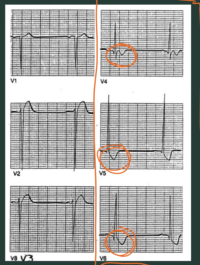 <p>What type of hypertrophy?</p>