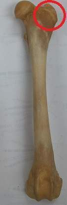 <p>Trochanter </p>