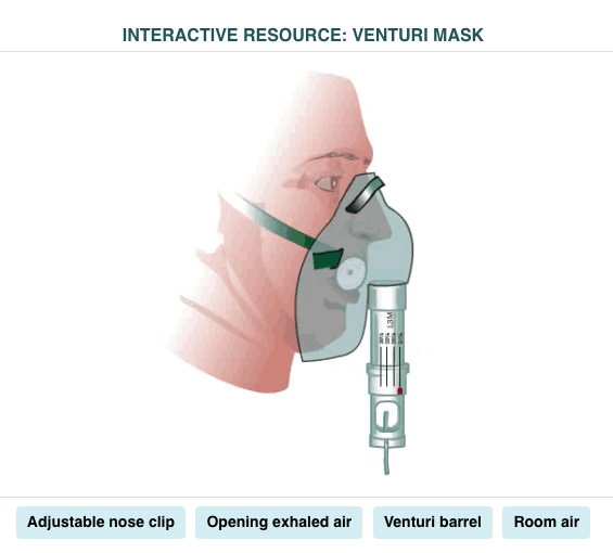 <p>Venturi Mask</p>