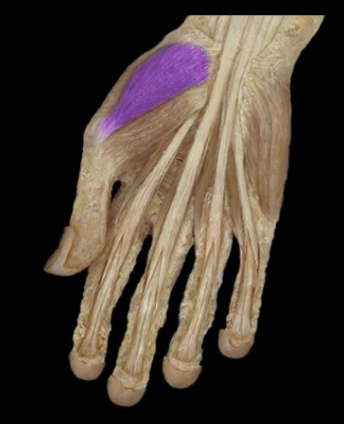 <p>What the highlighted structure is acting on the <strong><mark data-color="#f3b1cb" style="background-color: rgb(243, 177, 203); color: inherit;">Thenar Group</mark>.</strong> What muscle is this called?</p>