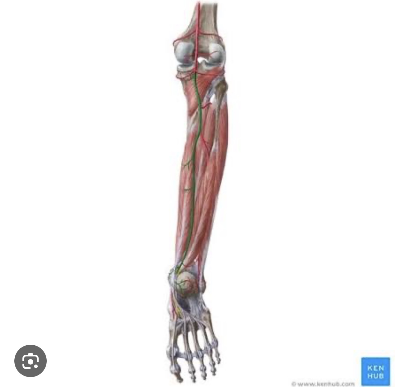 <p><span><span>a branch of the </span></span><a target="_blank" rel="noopener noreferrer nofollow" class="link" href="chatgpt://generic-entity?number=0" data-prevent-progress="true"><span><u><span>popliteal artery</span></u></span></a><span><span> that travels down the back of the lower leg. It supplies blood to the posterior muscles of the leg and passes behind the medial malleolus (inner ankle) before branching into arteries that supply the bottom of the foot.</span></span></p>