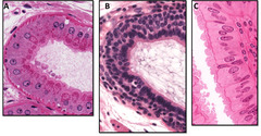 <p>Which epithelium is stratified?</p>