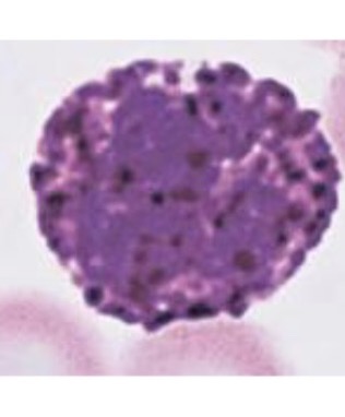 <p>What WBC is this? </p>