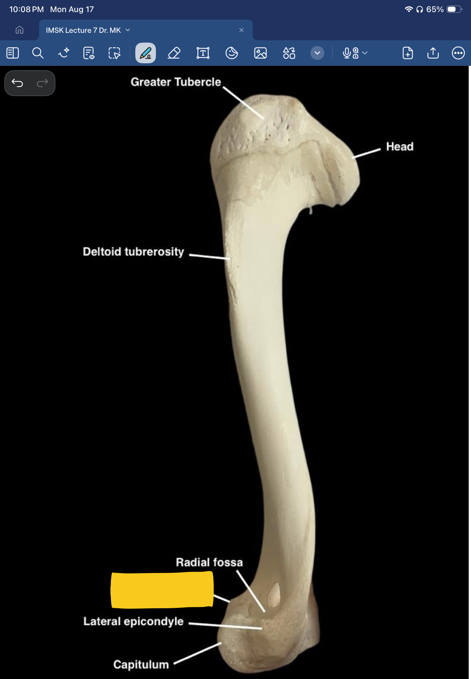 term image