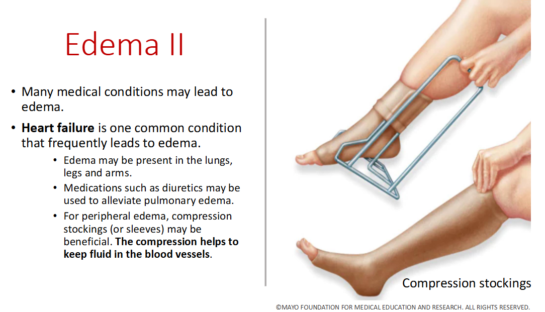 <p>Keeps fluids in blood vessels to prevent an edema</p>