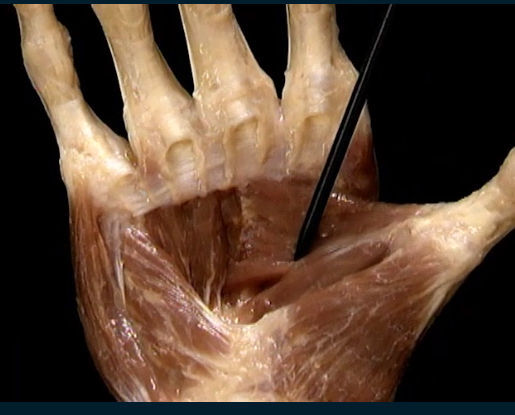 <p>Diep, Handpalm</p>