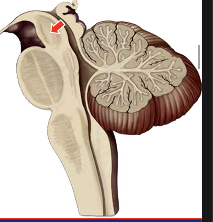 Identify the pointed part. Which cranial nerves originate from it?