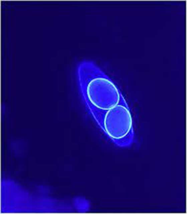 <p><span>Calcofluor White Stain</span></p>