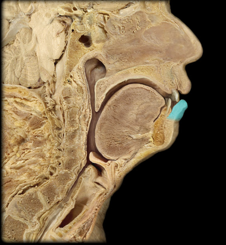 term image