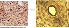 <p>What type of connective tissue is this?</p>