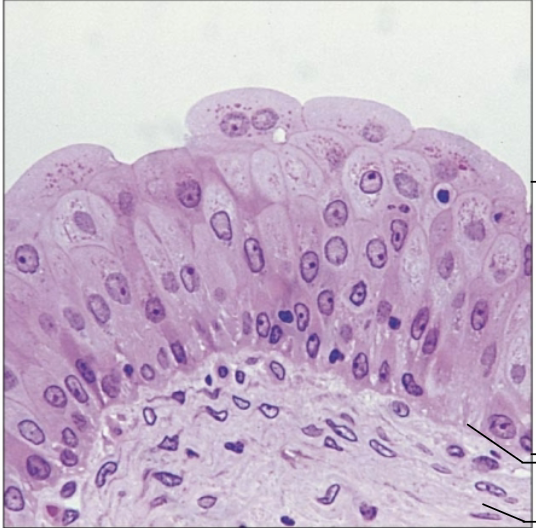 <p>What Tissue?</p>