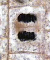 <p>Identify the line that is forming between the two cells.</p>
