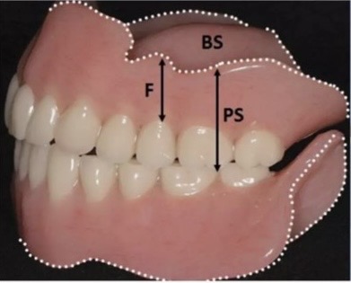 <p>Denture flange</p>