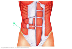 <p>Identify the indicated muscle.</p>