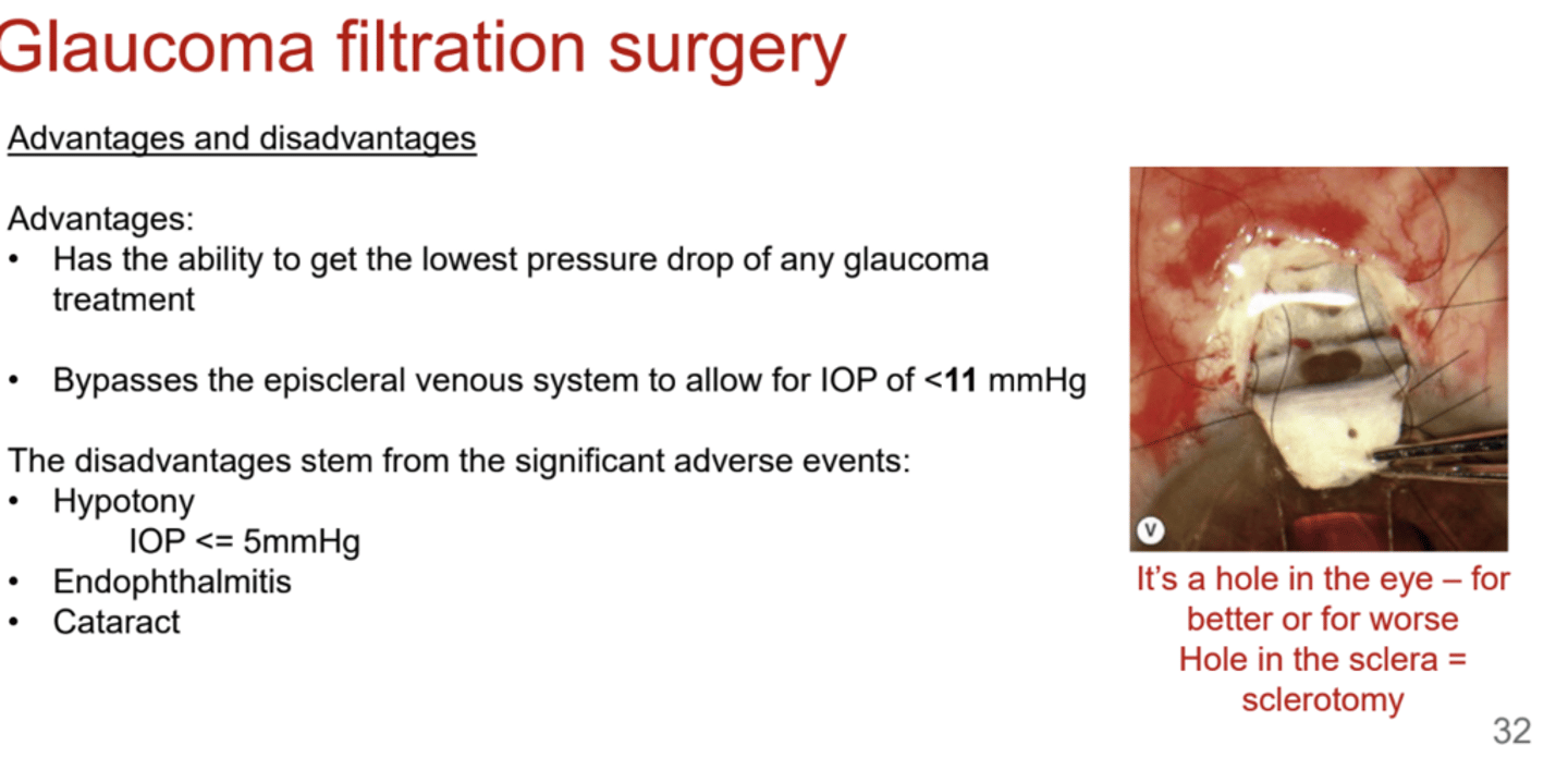 <p>Without glaucoma bypass surgery, what is the floor for how low IOP can be dropped?</p>