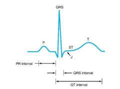 <p>atrial depolarization</p>