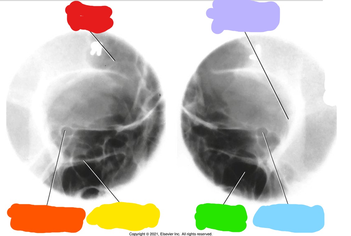 <p>What is Green?</p>