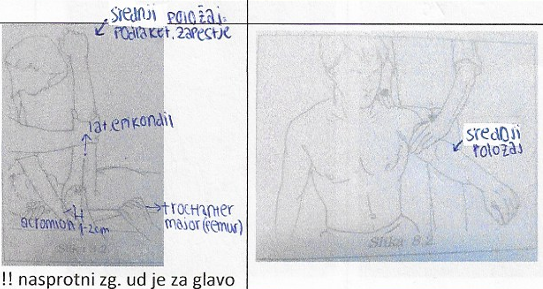 <p>antefleksija zg. uda</p>