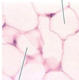 <p>what tissue is this</p>