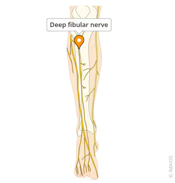 <p>deep fibular nerve</p>