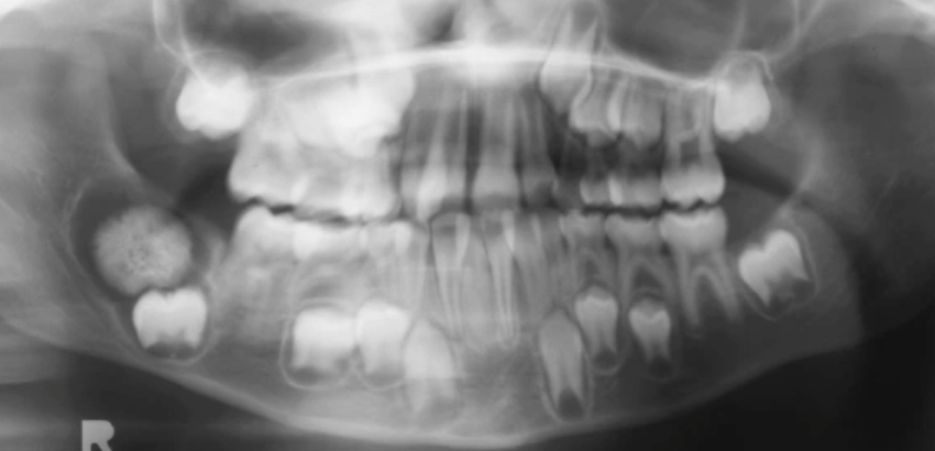 <p>what is the most likely diagnosis </p>