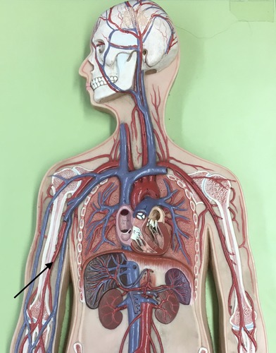 term image