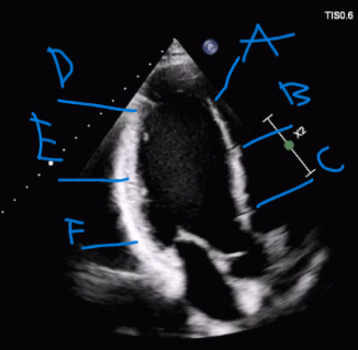<p>What segment is at B? </p>